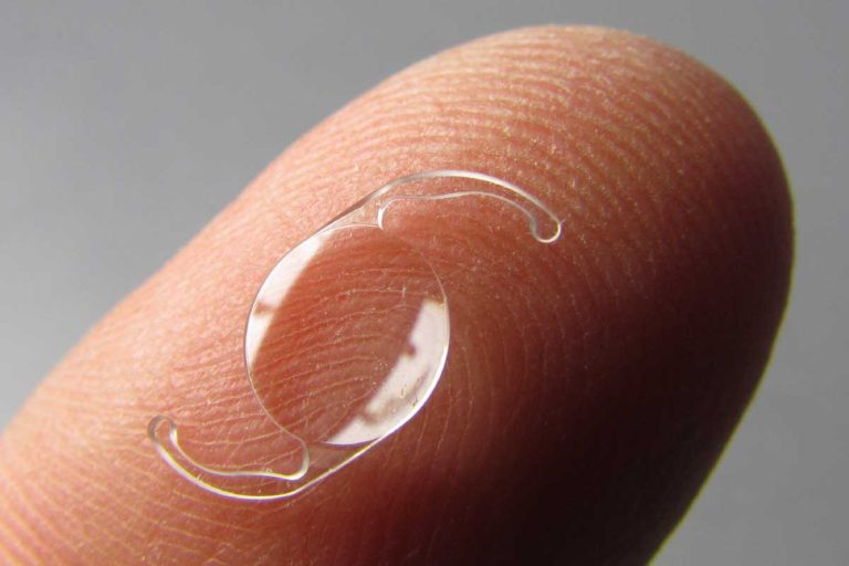 Lens Implants Hashmanis Group of Hospital